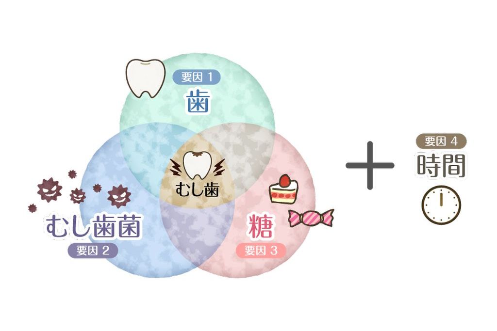むし歯の原因とは？